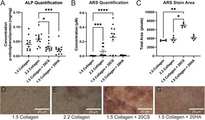 Glycosaminoglycans affect endothelial to mesenchymal transformation, proliferation, and calcification in a 3D model of aortic valve disease